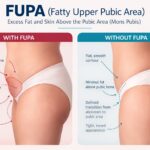 Understanding what is a fupa​: What It Is and Everything You Should Know