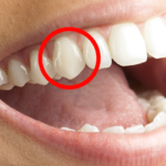 Why Canine Teeth Matter: Small Points with Big Purpose