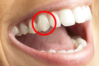 Why Canine Teeth Matter: Small Points with Big Purpose
