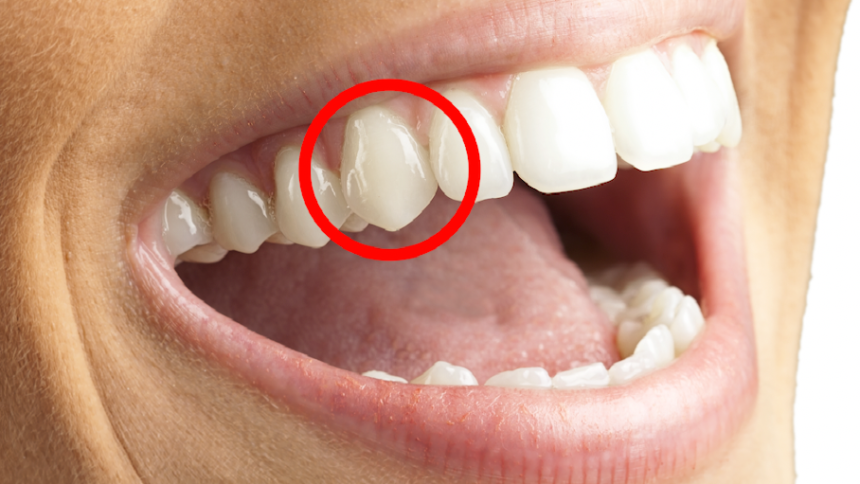 Why Canine Teeth Matter: Small Points with Big Purpose